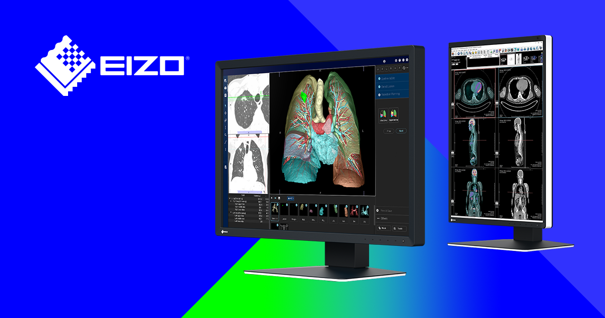 Case studies | Medical monitors from EIZO